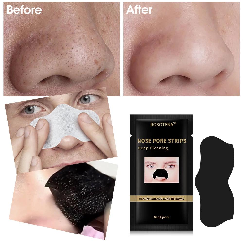 Remove Blackhead Blemish - upzone