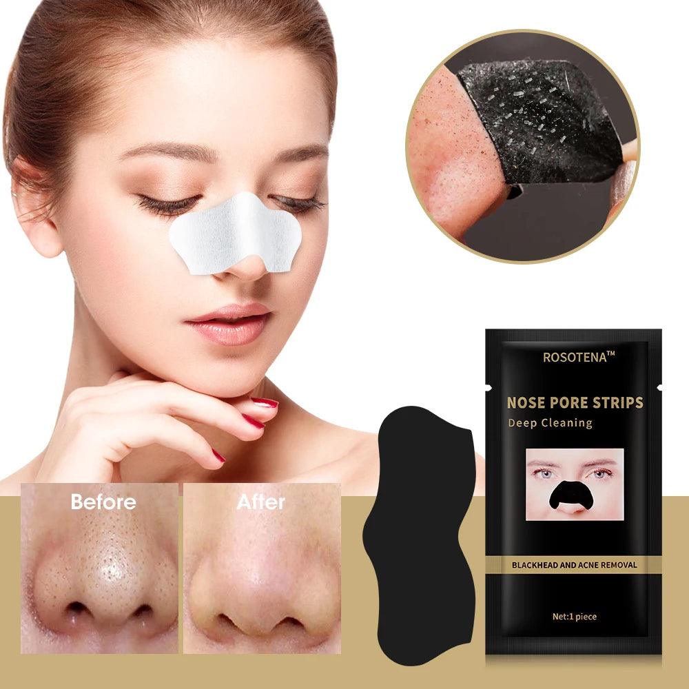 Remove Blackhead Blemish - upzone